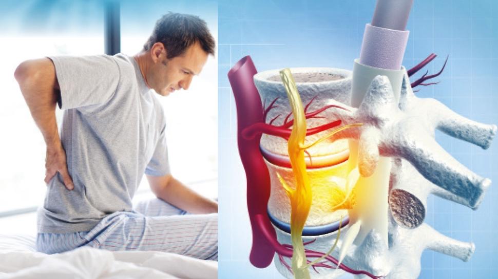 Ftktan ameliyatsz kurtulmak mmkn