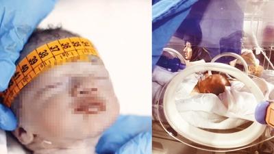 Ahsen bebei drp ldrdler... zel hastanedeki skandala 6'ar yl