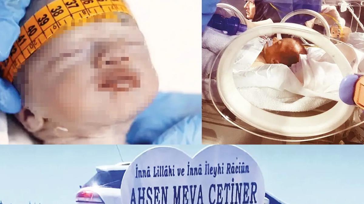 Ahsen Meva bebek lm hapis istemi fotoraflar resimleri