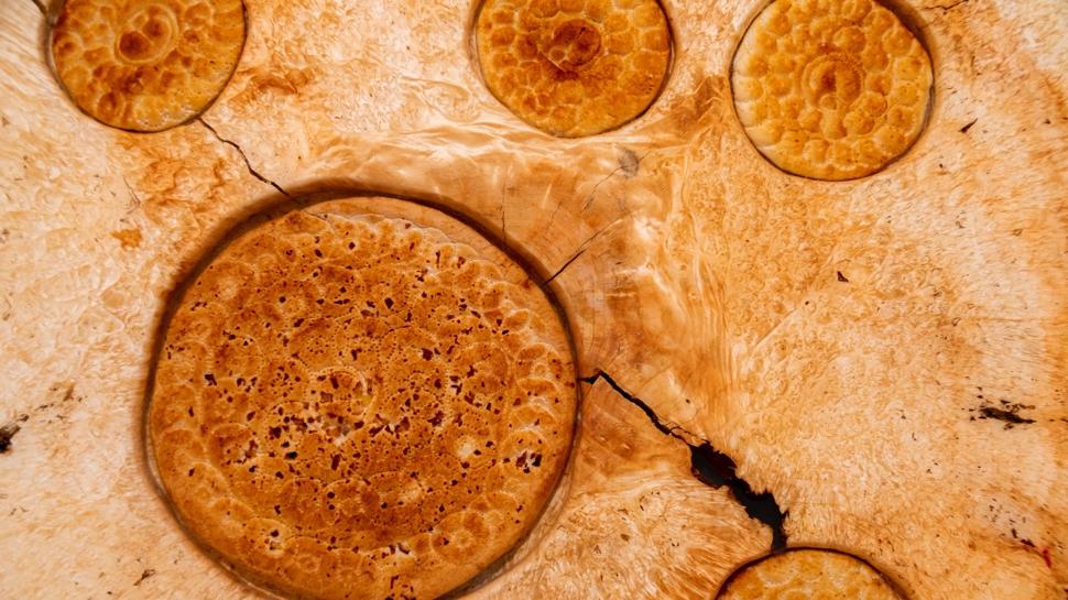 Çocuklarda böbrek taşı yaptıran besinler: Uzmanı açıkladı