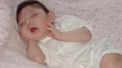 Beyin'siz 20 ya mucizesi