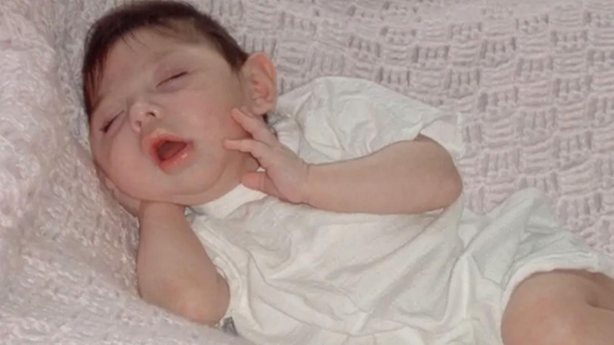 kk beyin dokusu yok denilebilecek 20 yana gelmek fotoraflar resimleri