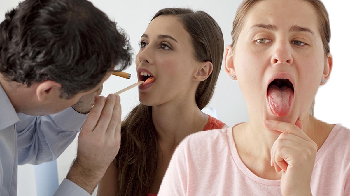 dil rengi dil rengine gre hastalk kanser diyabet fotoraflar resimleri