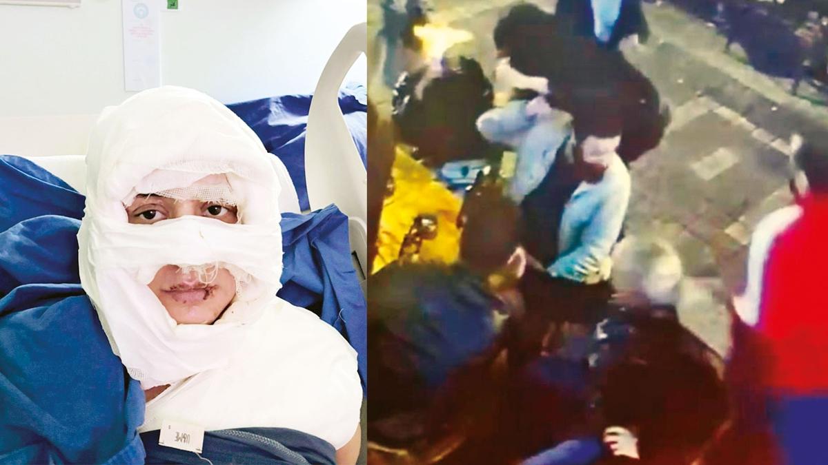 Gzde Ylmaz  Yangn  Saldrgan  Sevgilim  Dehet  Elence mekn  Ate fotoraflar resimleri