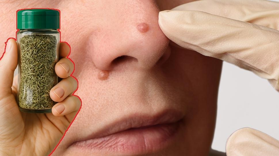 Siğilleri söküp atan baharat! İbn-i Sina'nın baharat formülü ne kurt bırakıyor ne mikrop