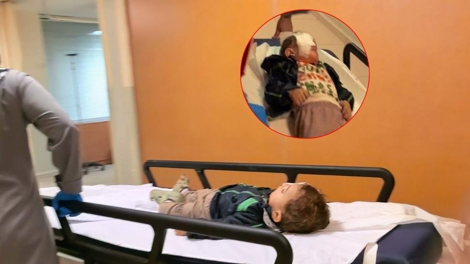 Patlayan torpil 2 yaşındaki çocuğu kör etti