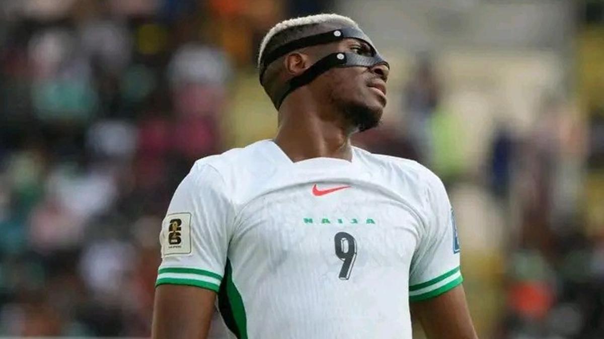 Victor Osimhen Galatasaray Sakatlk fotoraflar resimleri