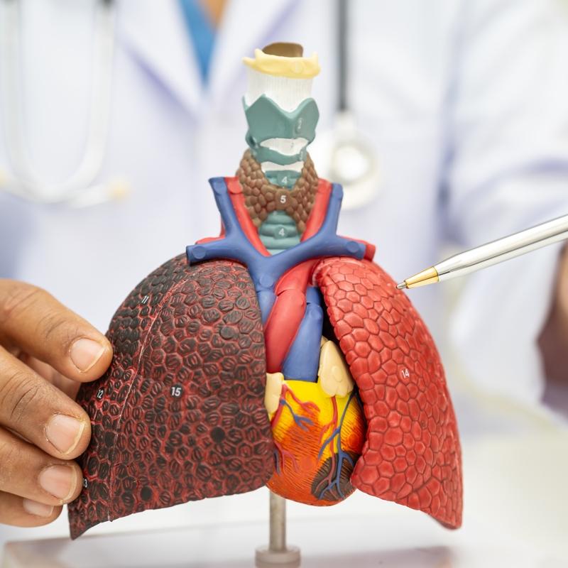 Dikkat! Kt huylu nodl kanser iareti olabilir