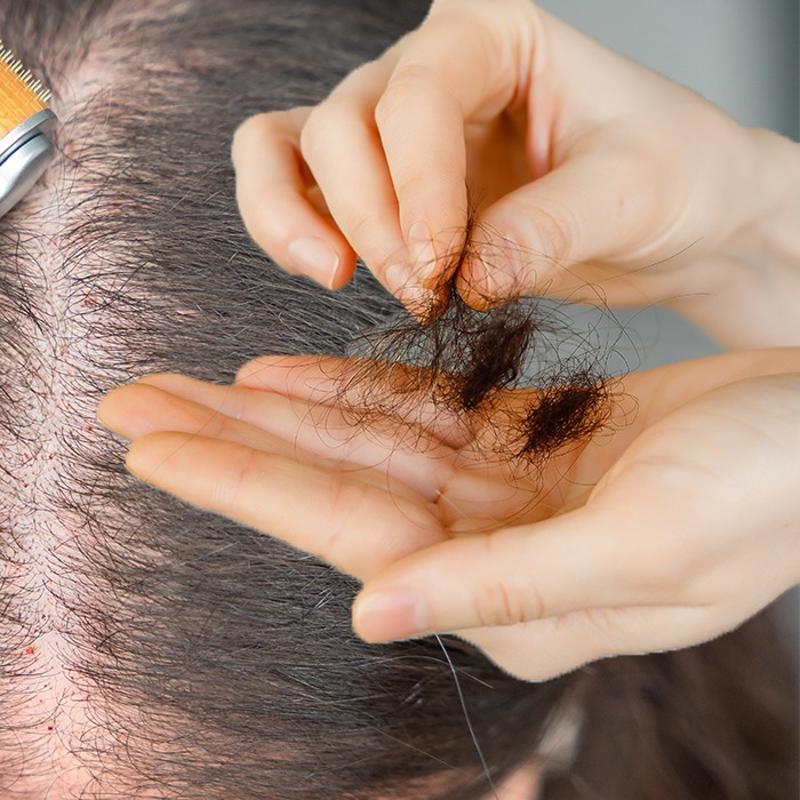 Sa kklerini alevlendiren karm! 3 admda srma sal olmann pf noktas