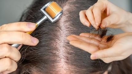 Sa kklerini alevlendiren karm! 3 admda srma sal olmann pf noktas