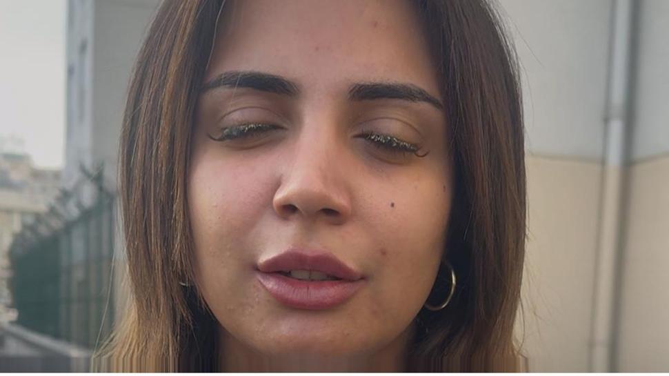 Güzelleşmek isterken dehşeti yaşadı! Kör olmaktan kıl payı kurtuldu