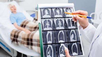 Yryen zatrre vakalar patlyor: Souk algnl zannediliyor ama...