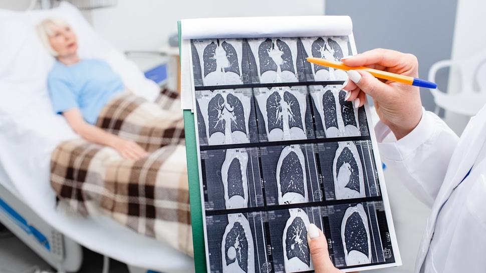 Yürüyen zatürre vakaları patlıyor: Soğuk algınlığı zannediliyor ama...