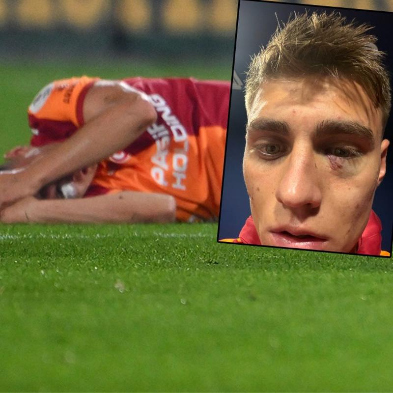 Galatasaray'dan Kazmcan Karata paylam! Yzne yabanc madde gelmiti