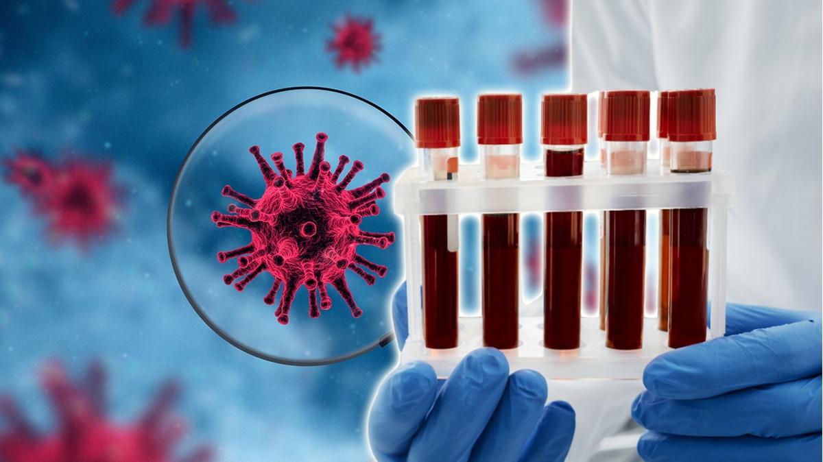 kan grubu yapay zeka grip ksrk hastalk fotoraflar resimleri