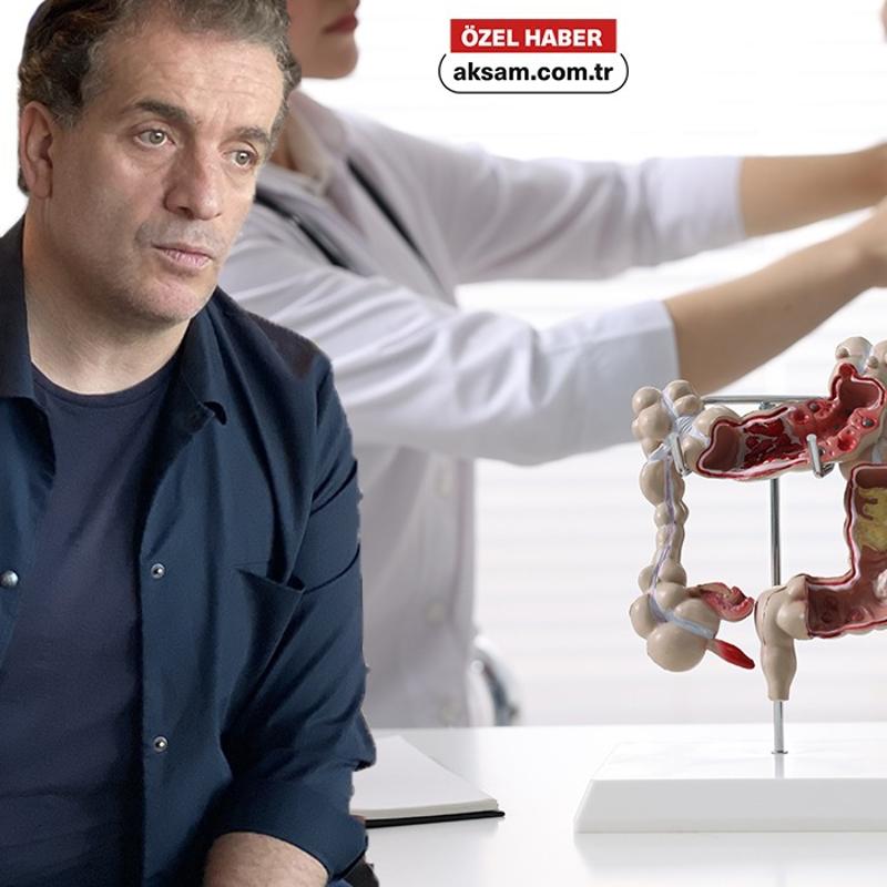 Murat Cemcir'in acil durumu hatrlatt: Divertikl kanamas nedir, belirtileri neler?