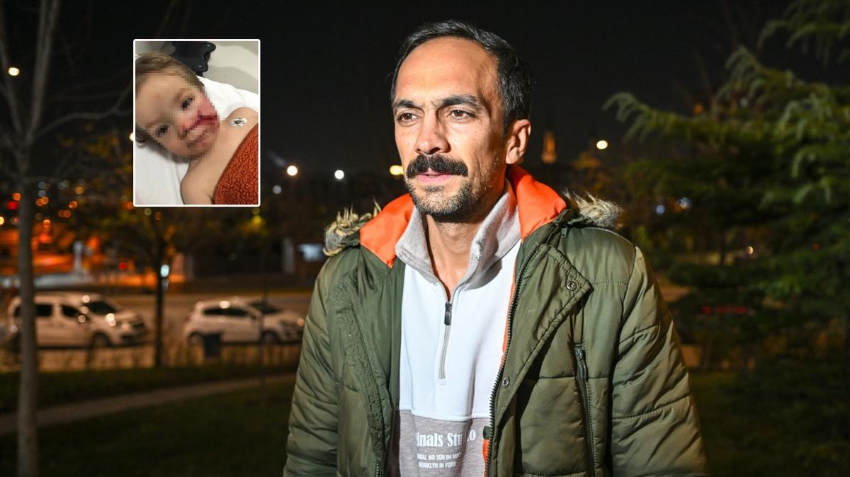 Ankara Pitbull Saldr Adem ztrk Hastane ocuk Ziyaret Yzleri fotoraflar resimleri