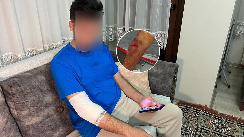 Köpek saldırısında kanlar içinde kaldı