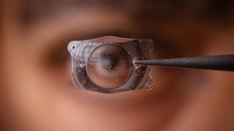 Protez göz çipi Avrupa'da görme kaybına umut oldu