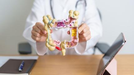 80 ya��na kadar �o�u insanda geli�en ba��rsak hastal��� nedir?