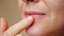 Demir eksikli�inin 7 belirtisi: Kendini soluk dudaklardan belli ediyor