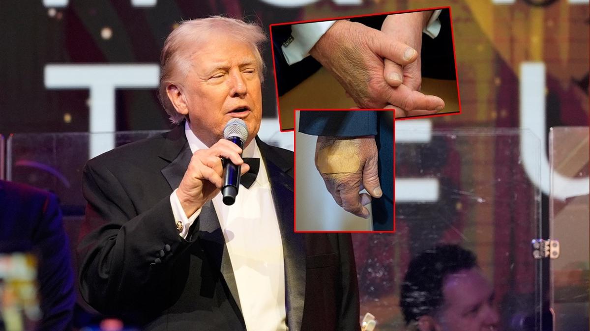 Trump ABD Sa�l�k Morluk foto�raflar� resimleri