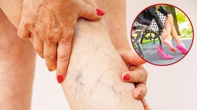 Varise davetiye ��karan hatalar