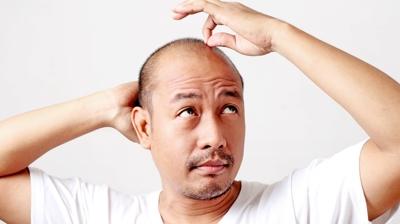 G�ney Koreli erkeklere m�jde!! Devlet kellere sa� ektirecek