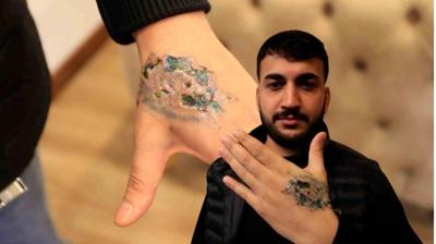 D�vme facias�! Sildirmek isterken elinden oldu