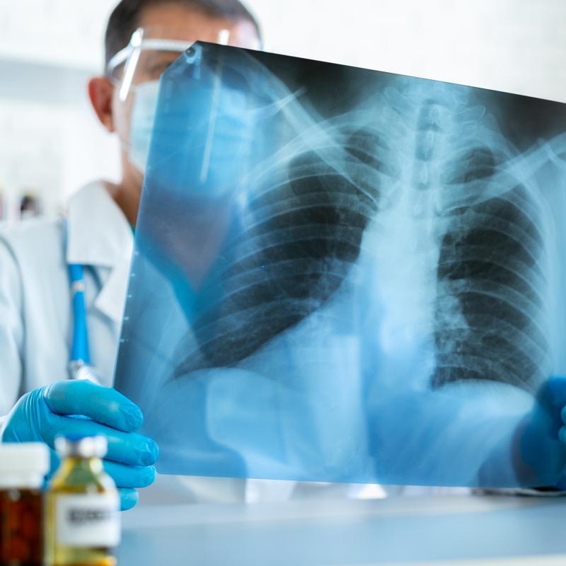 Verem geri mi d�n�yor? Uzman�ndan �nemli uyar�lar