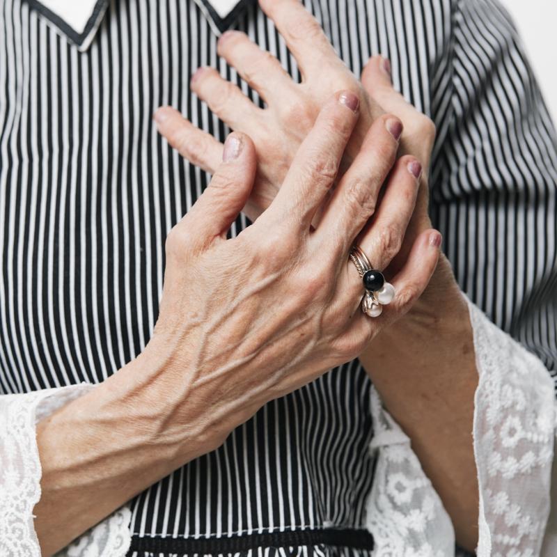 25 ya��nda ama 60 ya��nda g�r�n�yor! Baz� insanlar�n damarlar� neden belirgindir?