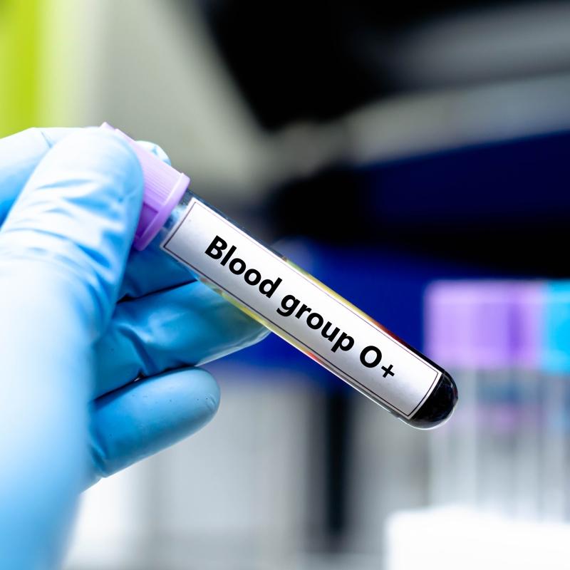 Kafas� �al��an kan grubu belli oldu: Zekalar� bir numara