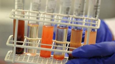 Y�zy�l�n deneyinde T�rkiye imzas�: Kritik ara�t�rmada yeni tespitler