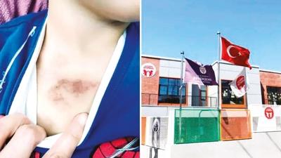 �BB kre�indeki daya�a �ifte soru�turma