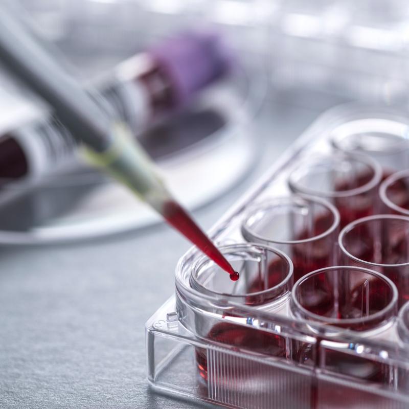 Kanser tedavilerinde yeni geli�meler! Uzman� a��klad�