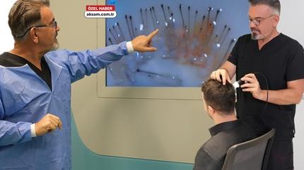 Uzman� sa� ekimi i�in uyard�: Kuaf�re gider gibi sa� ektiriyorlar, oysa karaci�er iflas edebilir