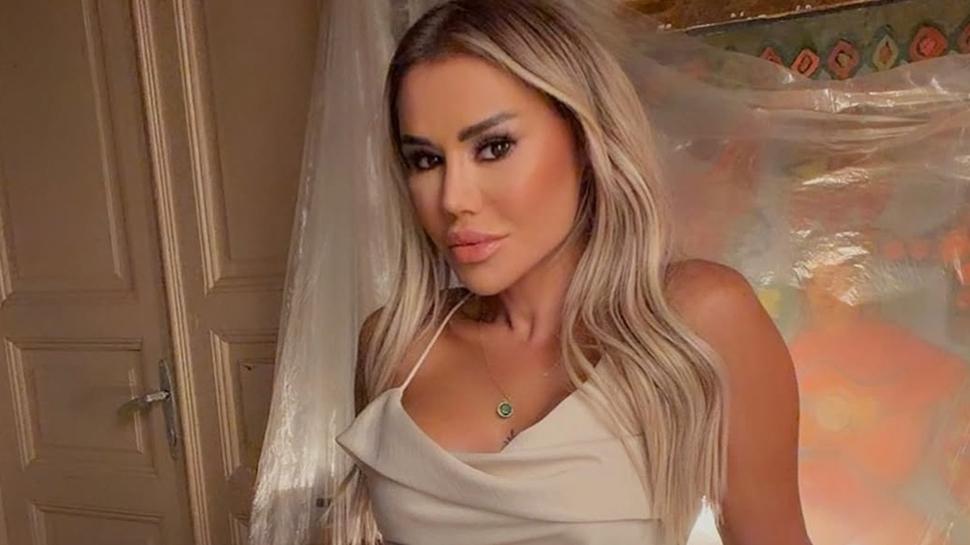 Ceylan ‘Dolgu yaptırmıyorum' dediği için linçlenmişti! Estetik açıklaması şoke etti…