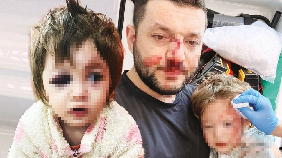 Bu yavruya nas�l vurdunuz