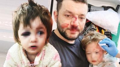 Bu yavruya nas�l vurdunuz?