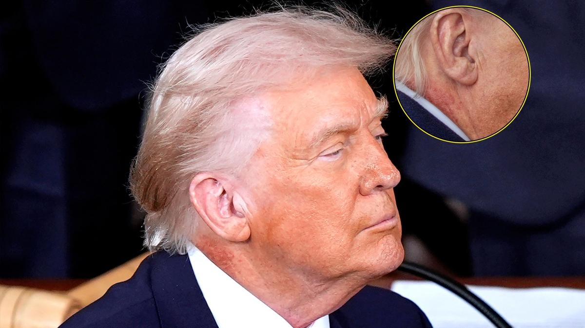 Trump ABD Sa�l�k foto�raflar� resimleri