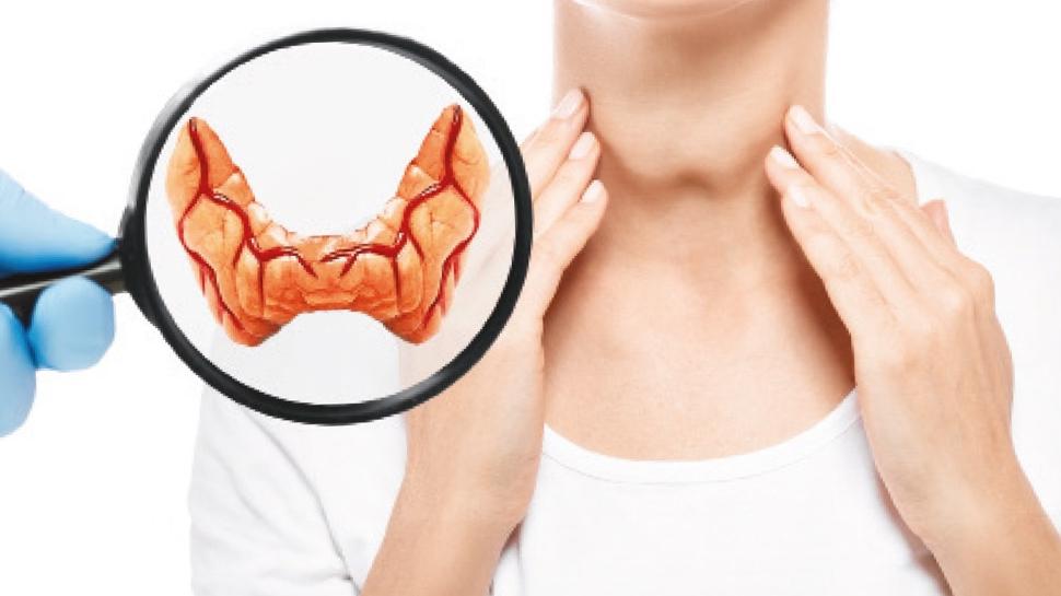 Tiroitlerden ne�tersiz kurtulu�