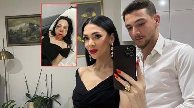 Bayram günü kafede dehşet: 'Küfür etmeyin' diyen kadını dövdüler