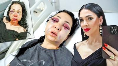 'Küfür etmeyin' dedi bu hale geldi! Oğlunun önünde eşkıya dayağı