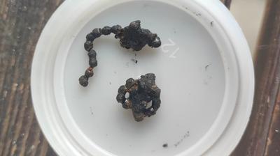 Rize'de akıllara durgunluk veren olay! 5 yaşındaki çocuğun burnundan çıkarıldı