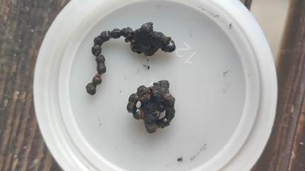 Ak�llara durgunluk veren olay! 5 ya��ndaki �ocu�un burnundan ��kar�ld�