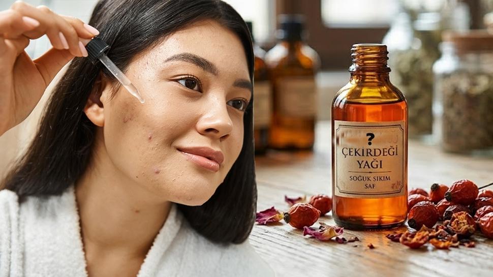 Sivilce izlerini tek gecede siliyor! Aktarlar�n en �ok satt��� o gizemli ya�