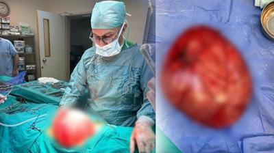 Kilo vermek i�in doktora gitmi�ti: �ocuktan 3,5 kiloluk kist ��kt�