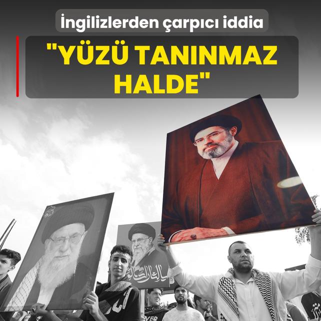 �ngilizlerden �arp�c� iddia: Y�z� tan�nmaz halde