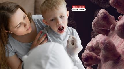 A��s� yok, ilac� yok! Di�er vir�slerle birle�ince �ld�r�yor! Uzman�, Bocavir�s belirtilerini a��klad�