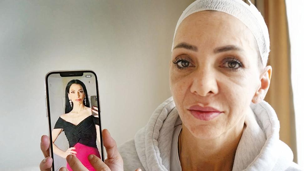 Zanlıdan pişkin savunma! Dövmedik merdivenden düştü